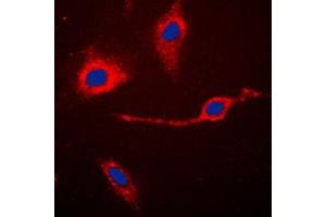 Immunofluorescent analysis of Caspase 3 p17 staining in Jurkat cells. (Caspase 3 p17 (Center) 抗体)