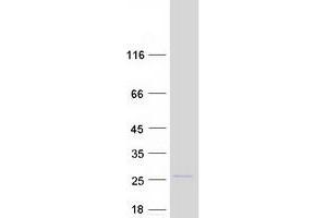 Western Blotting (WB) image for Cysteine and Glycine-Rich Protein 1 (CSRP1) (Transcript Variant 1) protein (Myc-DYKDDDDK Tag) (ABIN2712584)