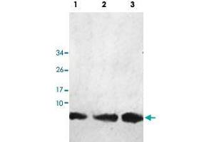 Western blot analysis of human fetal kidney (Lane 1), fetal liver (Lane 2) and fetal heart (Lane 3) lysate with HHLA3 polyclonal antibody  at 1 : 1000 dilution. (HHLA3 抗体  (AA 1-122))