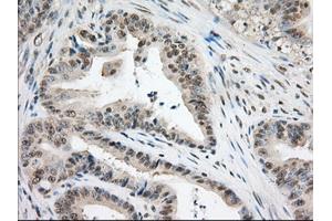 Image no. 10 for anti-Transforming, Acidic Coiled-Coil Containing Protein 3 (TACC3) antibody (ABIN1498097) (TACC3 抗体)