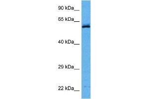 Western Blotting (WB) image for anti-Chaperonin Containing TCP1, Subunit 8 (Theta) (CCT8) (C-Term) antibody (ABIN2782379)