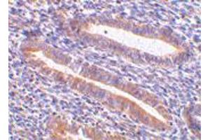 Immunohistochemistry of HAVCR1 in human uterus tissue with HAVCR1 polyclonal antibody  at 10 ug/mL . (HAVCR1 抗体  (N-Term))
