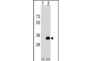 Western blot analysis of DOK5 (arrow) using rabbit polyclonal DOK5 Antibody (N-term) (ABIN1539174 and ABIN2848803). (DOK5 抗体  (N-Term))