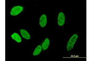 Immunofluorescence of purified MaxPab antibody to C13orf8 on HeLa cell. (ZNF828 抗体  (AA 1-812))
