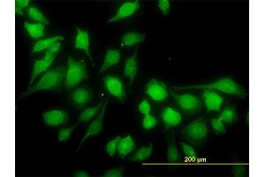 Immunofluorescence of monoclonal antibody to RP6-213H19. (STK26/MST4 抗体  (AA 331-415))