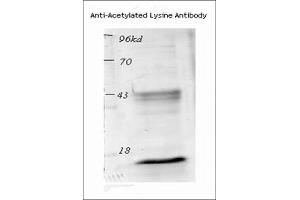 Western blot analysis of Mouse Spleen lysates showing detection of Acetylated Lysine protein using Rabbit Anti-Acetylated Lysine Polyclonal Antibody . (Lysine (lys) (acetylated) 抗体 (HRP))