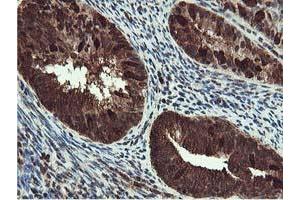 Image no. 5 for anti-RuvB-Like 2 (E. Coli) (RUVBL2) (AA 113-370) antibody (ABIN1490850)