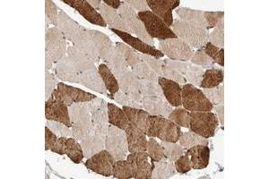 Immunohistochemical staining of human skeletal muscle with SYDE2 polyclonal antibody  shows strong cytoplasmic positivity in subsets of muscle fibers at 1:50-1:200 dilution. (SYDE2 抗体)