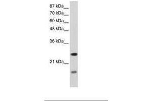 Image no. 2 for anti-Signal Recognition Particle 14kDa (Homologous Alu RNA Binding Protein) (SRP14) (AA 38-87) antibody (ABIN202027) (SRP14 抗体  (AA 38-87))