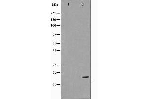Western blot analysis on COS7 cell lysate using p18 INK Antibody,The lane on the left is treated with the antigen-specific peptide. (P18 INK 抗体)