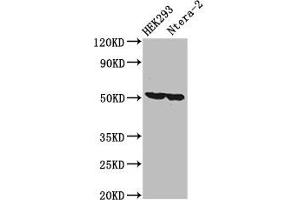 Western Blot Positive WB detected in: HEK293 whole cell lysate, Ntera-2 whole cell lysate All lanes: RUVBL1 antibody at 3. (RUVBL1 抗体  (AA 101-400))