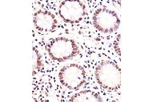 Paraformaldehyde-fixed, paraffin embedded human small intestine tissue, Antigen retrieval by boiling in sodium citrate buffer (pH6. (MGMT 抗体)