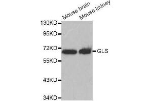 Western blot analysis of extracts of various cell lines, using GLS antibody. (Glutaminase 抗体  (AA 610-669))