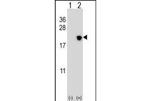 Western blot analysis of NIP7 (arrow) using rabbit polyclonal NIP7 Antibody (C-term) (ABIN652635 and ABIN2842425). (NIP7 抗体  (C-Term))