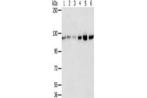 Western Blotting (WB) image for anti-RNA Binding Motif Protein 5 (RBM5) antibody (ABIN2430715) (RBM5 抗体)