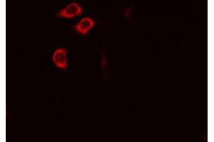 ABIN6274524 staining RAW264. (IARS2 抗体  (N-Term))