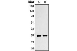 Western blot analysis of PRRX1 expression in NCIH292 (A), NIH3T3 (B) whole cell lysates. (PRRX1 抗体  (Center))