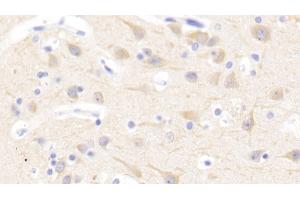 Detection of NFE2L2 in Human Cerebrum Tissue using Polyclonal Antibody to Nuclear Factor, Erythroid Derived 2 Like Protein 2 (NFE2L2) (NRF2 抗体  (AA 400-603))