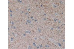 Used in DAB staining on fromalin fixed paraffin- embedded brain tissue (DLG5 抗体  (AA 1722-1905))