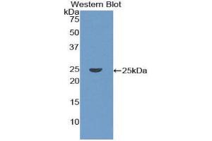 Western Blotting (WB) image for anti-Coronin, Actin Binding Protein, 1A (CORO1A) (AA 7-204) antibody (ABIN1858472) (Coronin 1a 抗体  (AA 7-204))