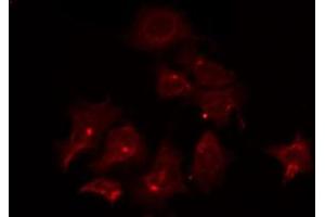 ABIN6266797 staining COLO205 by IF/ICC. (ATF6B 抗体  (Internal Region))