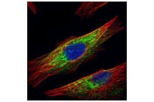 ICC/IF Image Confocal immunofluorescence analysis (Olympus FV10i) of paraformaldehyde-fixed HeLa, using HDAC6, antibody (Green) at 1:500 dilution. (HDAC6 抗体  (N-Term))