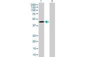 Western Blot analysis of DLST expression in transfected 293T cell line by DLST MaxPab polyclonal antibody.