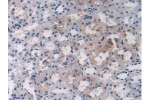 IHC-P analysis of Rat Liver Tissue, with DAB staining. (OAS1 抗体  (AA 139-358))
