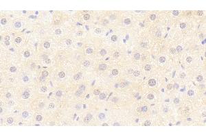 Detection of Flt3L in Mouse Liver Tissue using Polyclonal Antibody to FMS Like Tyrosine Kinase 3 Ligand (Flt3L) (FLT3LG 抗体  (AA 27-189))