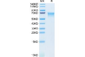 Human MADCAM1 on Tris-Bis PAGE under reduced condition. (MADCAM1 Protein (AA 19-317) (His tag))