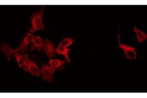 ABIN6266543 staining LOVO by IF/ICC. (GAD 抗体  (C-Term))