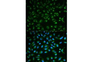 Immunofluorescence analysis of MCF7 cell using NT5E antibody. (CD73 抗体)
