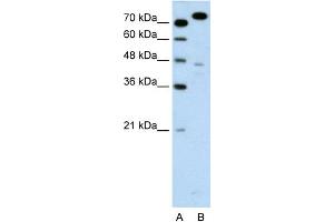 WB Suggested Anti-MCM3 Antibody Titration:  0. (MCM3 抗体  (C-Term))