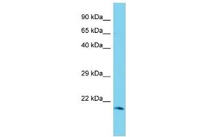 Host: Rabbit Target Name: Mrpl48 Sample Type: Rat Stomach lysates Antibody Dilution: 1. (MRPL48 抗体  (C-Term))
