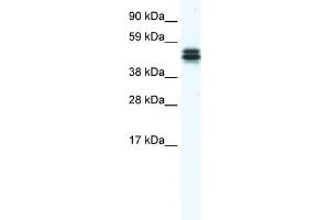 WB Suggested Anti-E130307M08RIK Antibody Titration:  1.