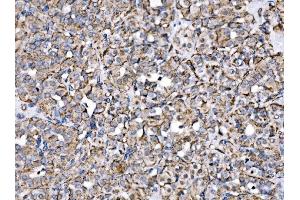 IHC analysis of MPPB/PMPCB using anti-MPPB/PMPCB antibody (ABIN7600758). (PMPCB 抗体  (AA 23-479))