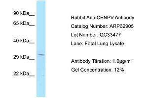 Western Blotting (WB) image for anti-Centromere Protein V (CENPV) (C-Term) antibody (ABIN2789289) (CENPV 抗体  (C-Term))