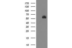 Image no. 1 for anti-serine Peptidase Inhibitor, Kunitz Type 1 (SPINT1) antibody (ABIN1501110) (SPINT1 抗体)