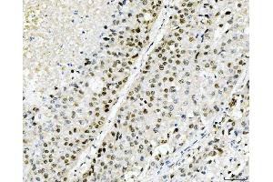 IHC analysis of Cyclophilin E/PPIE using anti-Cyclophilin E/PPIE antibody (ABIN7599242). (PPIE 抗体  (AA 1-301))