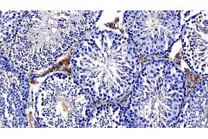 Detection of NOTCH2NL in Mouse Testis Tissue using Polyclonal Antibody to Notch2 N-Terminal Like Protein (NOTCH2NL) (NOTCH2NL 抗体  (AA 1-236))