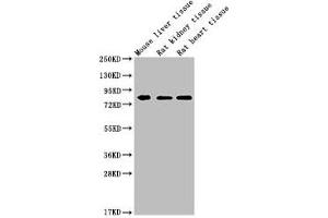 Western Blot Positive WB detected in: MMUT antibody at 1:1000 Lane 1: Mouse liver tissue Lane 2: Rat kidney tissue Lane 3: Rat heart tissue Secondary Goat polyclonal to Mouse IgG at 1/20000 dilution Predicted band size: 83 KDa Observed band size: 83 KDa Exposure time: 5 min (Histone 3 抗体  (AA 31-748))