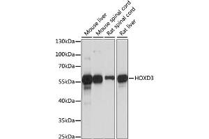Western blot analysis of extracts of various cell lines, using HOXD3 antibody (ABIN6290493) at 1:1000 dilution. (HOXD3 抗体)