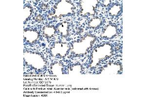 Rabbit Anti-EMP2 Antibody  Paraffin Embedded Tissue: Human Lung Cellular Data: Alveolar cells Antibody Concentration: 4. (EMP2 抗体  (Middle Region))