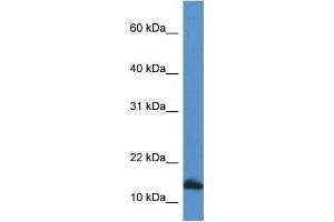 Western Blot showing CDA antibody used at a concentration of 1 ug/ml against HepG2 Cell Lysate (CDA 抗体  (C-Term))
