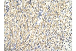Rabbit Anti-CDK4 antibody Catalog Number: ARP30259_P050  Paraffin Embedded Tissue: Human Heart cell  Cellular Data: Epithelial cells of renal tubule Antibody Concentration:  4. (CDK4 抗体  (C-Term))