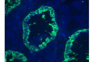 Image no. 2 for anti-Keratin 8 (KRT8) antibody (ABIN335327) (KRT8 抗体)