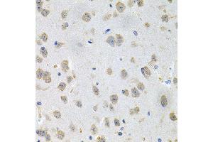 Immunohistochemistry of paraffin-embedded mouse brain using GNE antibody (ABIN5996449) at dilution of 1/100 (40x lens). (GNE 抗体)
