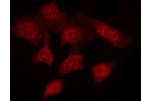 ABIN6272236 staining HEPG2 by IF/ICC. (Acrosin 抗体  (N-Term))