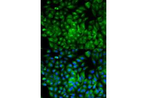 Immunofluorescence analysis of A549 cell using ATG16L1 antibody. (ATG16L1 抗体  (AA 90-300))
