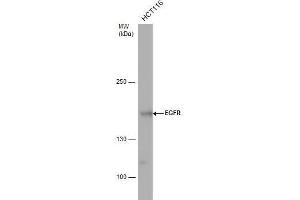 WB Image EGFR antibody detects EGFR protein by western blot analysis.